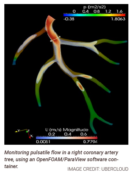 artery tree